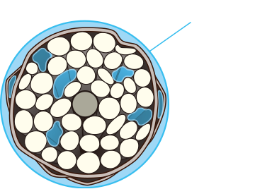 内側まで立体補修